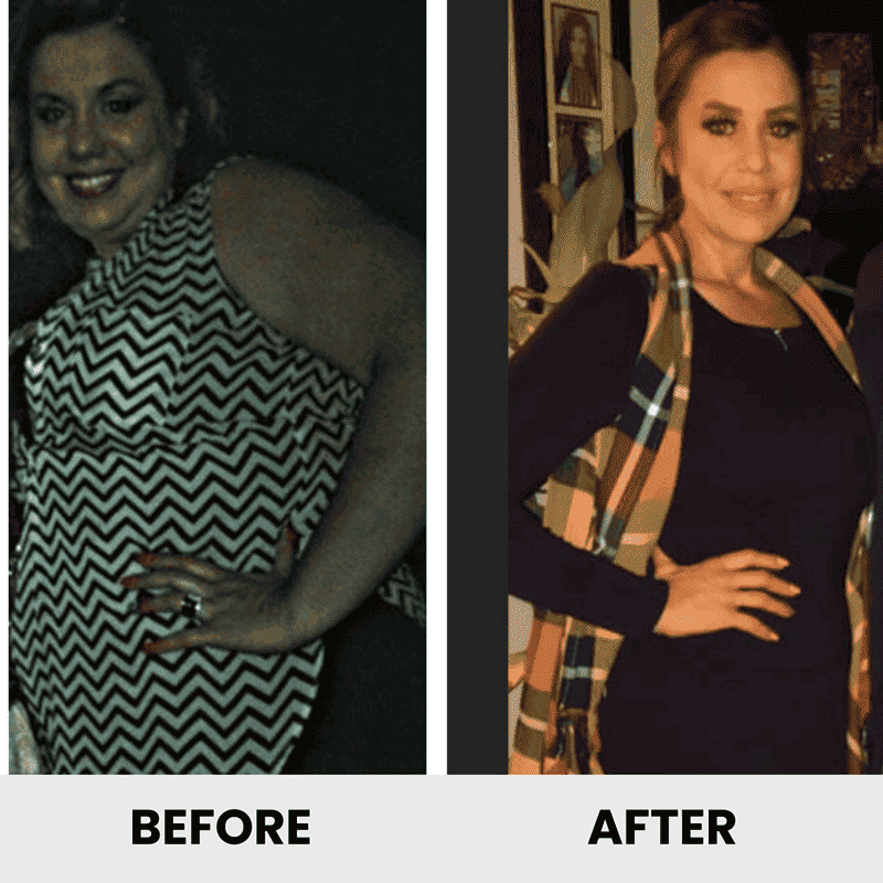 Antes y después - Laura Flores