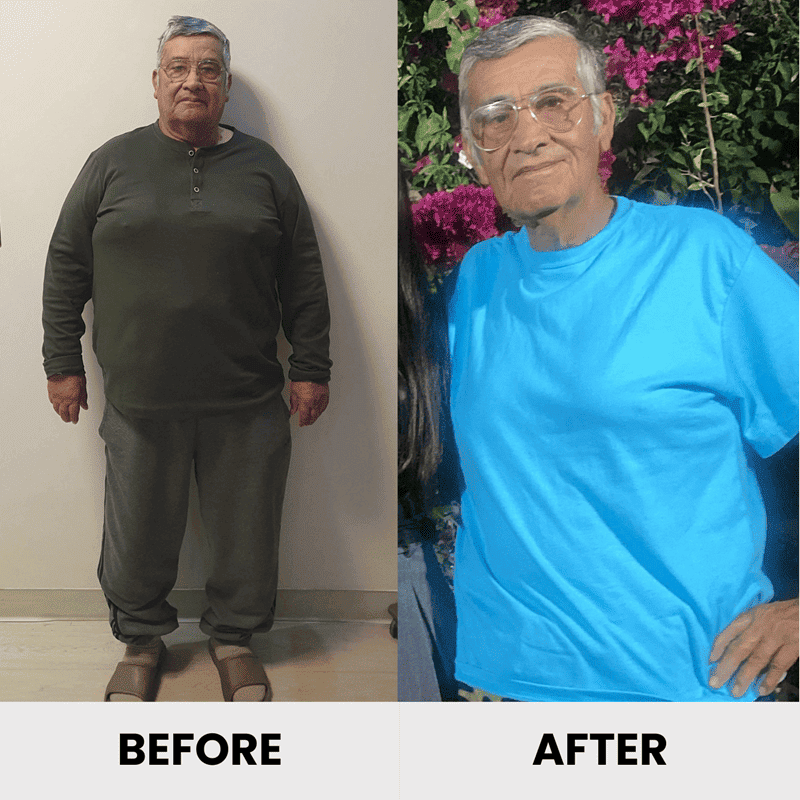 Antes y después - Ricardo V